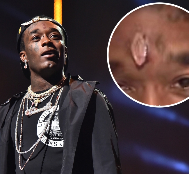 Лучшие друзья рэперов... Lil Uzi вживил в лоб бриллиант за 24 миллиона долларов.