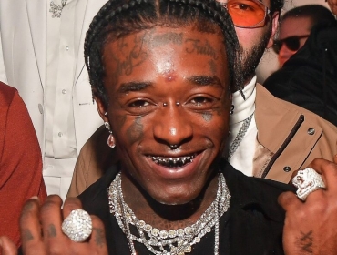 Красотка — это боль: Рэпер Lil Uzi удалил изо лба бриллиант за 24 миллиона долларов