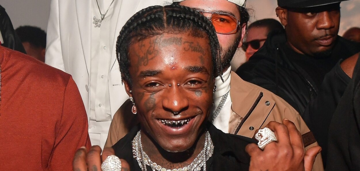 Красотка — это боль: Рэпер Lil Uzi удалил изо лба бриллиант за 24 миллиона долларов
