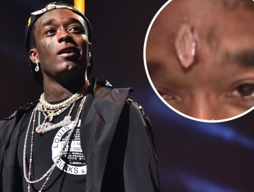 Лучшие друзья рэперов... Lil Uzi вживил в лоб бриллиант за 24 миллиона долларов.