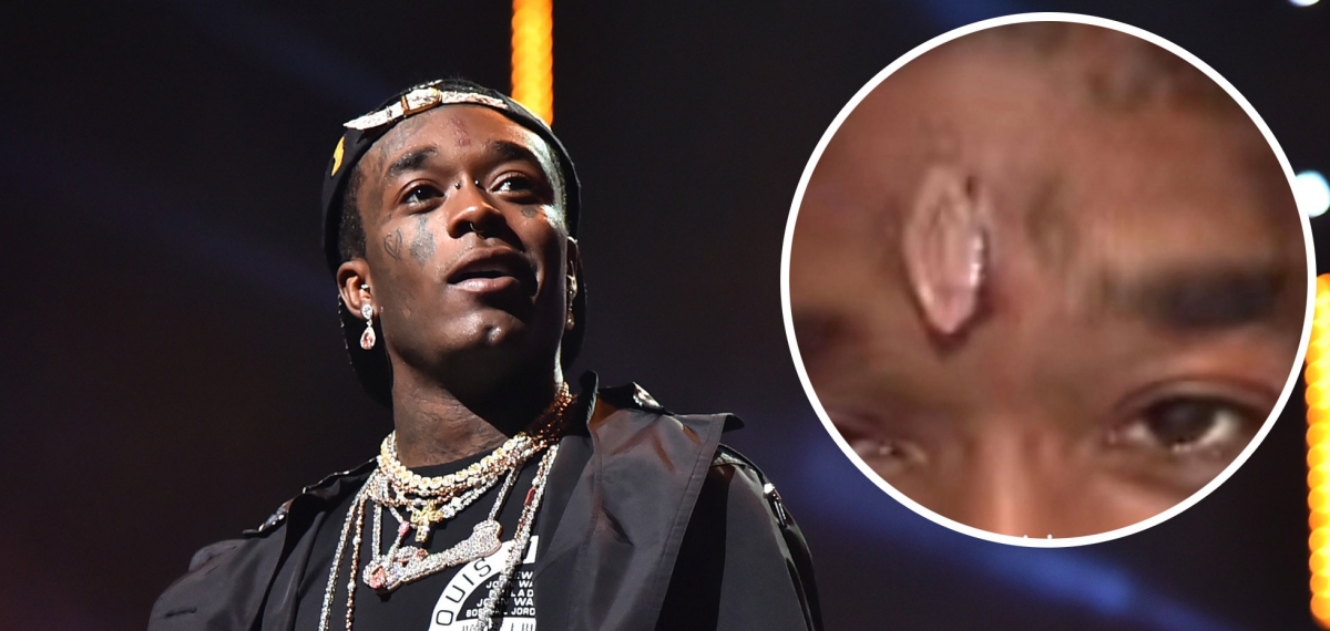 Лучшие друзья рэперов... Lil Uzi вживил в лоб бриллиант за 24 миллиона долларов.